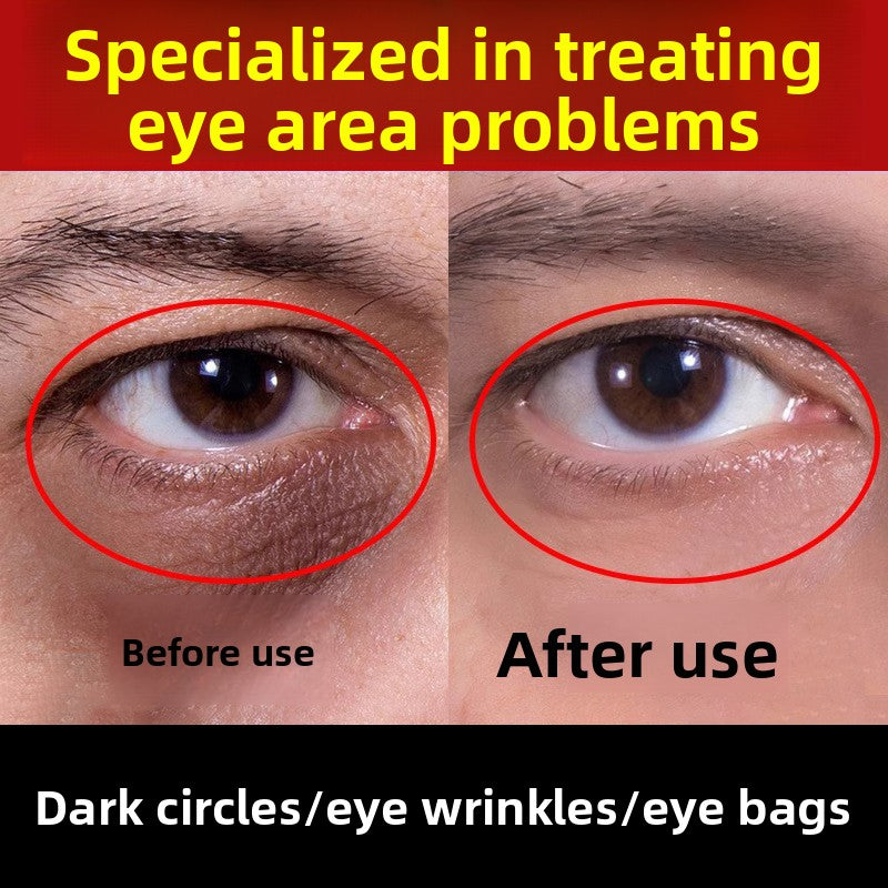 Anti-wrinkle and firming eye cream